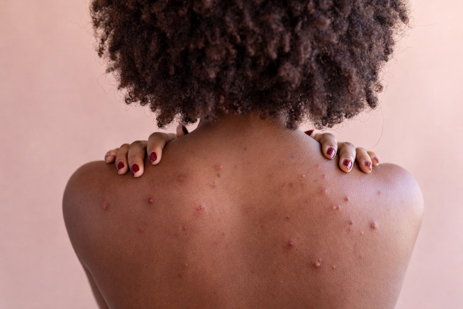 Back showing visible skin texture